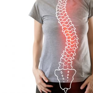 Scoliosis graphic on woman