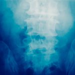 Xray lower spine
