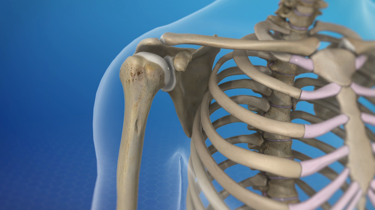 Shoulder Video Library