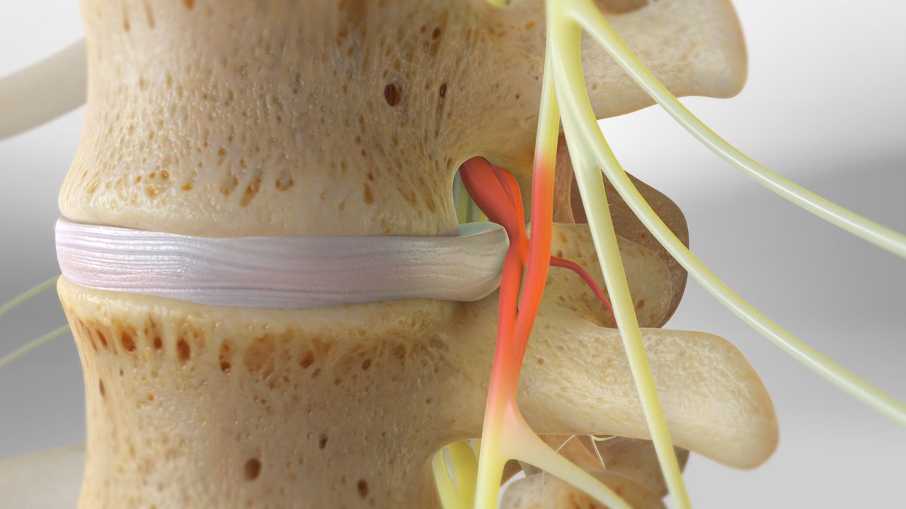 Spine & Scoliosis Video Library